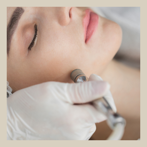 lady getting a microdermabrasion treatment