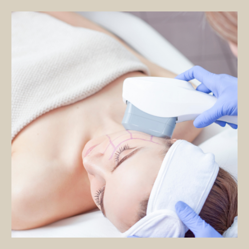 HIFU face treatment